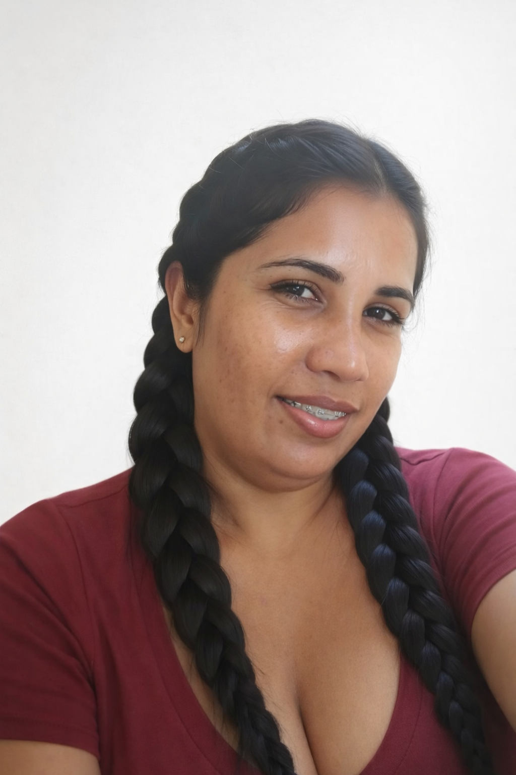 Ana Almeida 